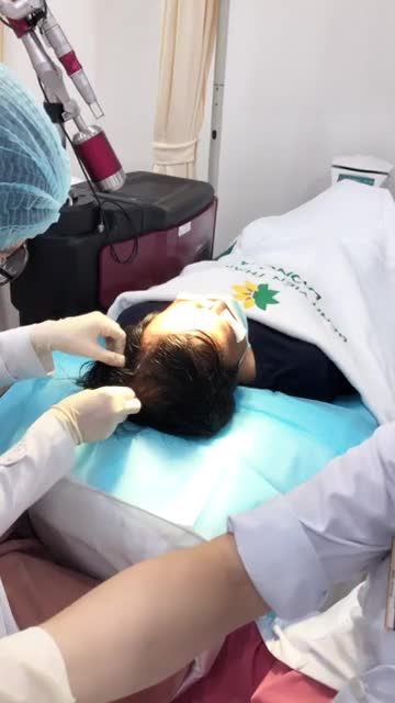 Quá trình tiêm Biohair điều trị rụng tóc cho khách Tại bệnh viện thẩm Mỹ Đông Á