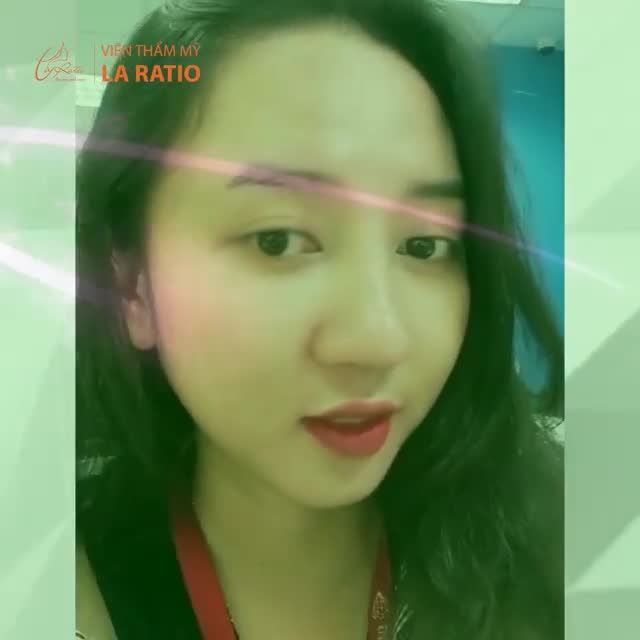 TÂM SỰ KHÁCH HÀNG VỚI DÁNG MŨI TỰ NHIÊN SAU 1 THÁNG THỰC HIỆN NÂNG MEGA S