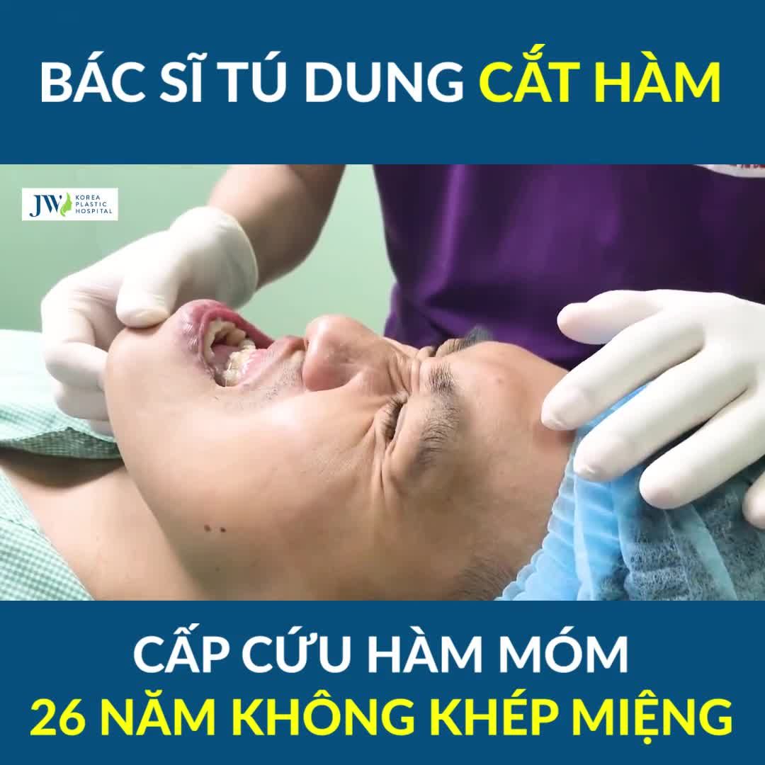 Bác sĩ Tú Dung CẮT HÀM TRÊN DỜI HÀM DƯỚI cứu HÀM MÓM NẶNG 26 năm