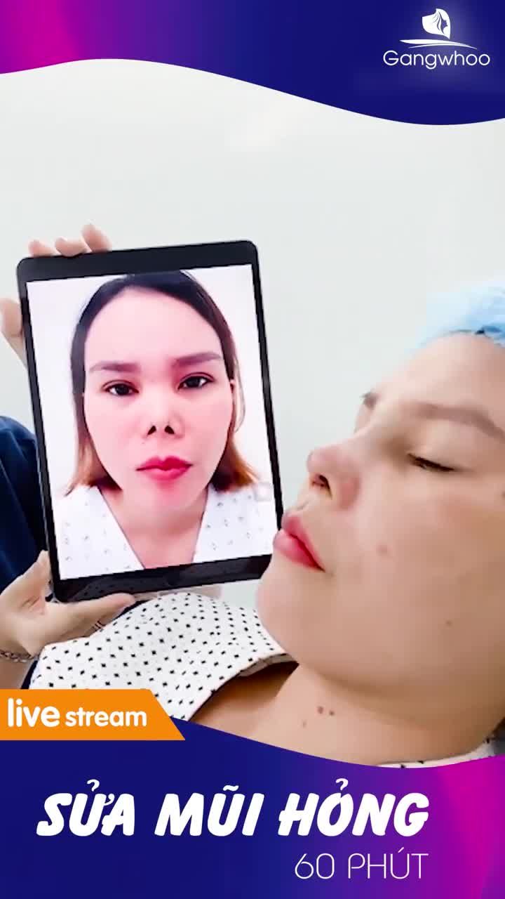 MŨI CO RÚT NẶNG KHÔNG CƠ SỞ NÀO DÁM NHẬN ĐẾN GANGWHOO 60 PHÚT KẾT QUẢ BẤT NGỜ