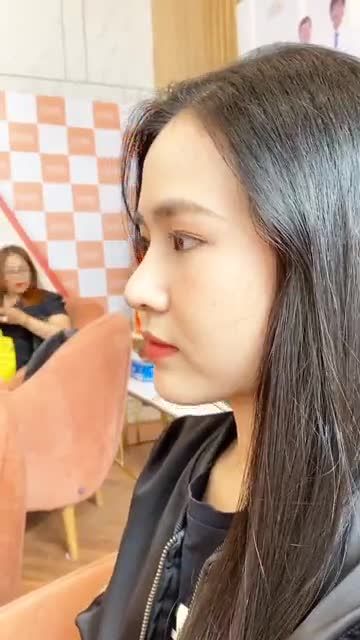 NÂNG MŨI SLINE TẠI AZ NOSE