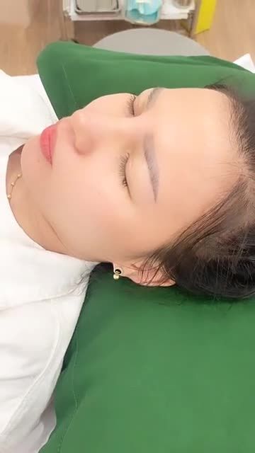 MŨI ĐẸP NGỠ NGÀNG SAU 10 NGÀY PHẪU THUẬT
