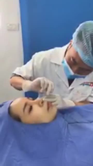 Cùng theo dõi bác sĩ cắt chỉ mũi sau 10 ngày!