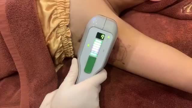 Mùi hôi cơ thể do tăng tiết mồ hôi khiến bạn khó chịu? Inbox ngay Dr.Hải Lê để có phương pháp điều trị triệt để chứng hôi nách và ra mồ hôi ẩm ướt khó chịu