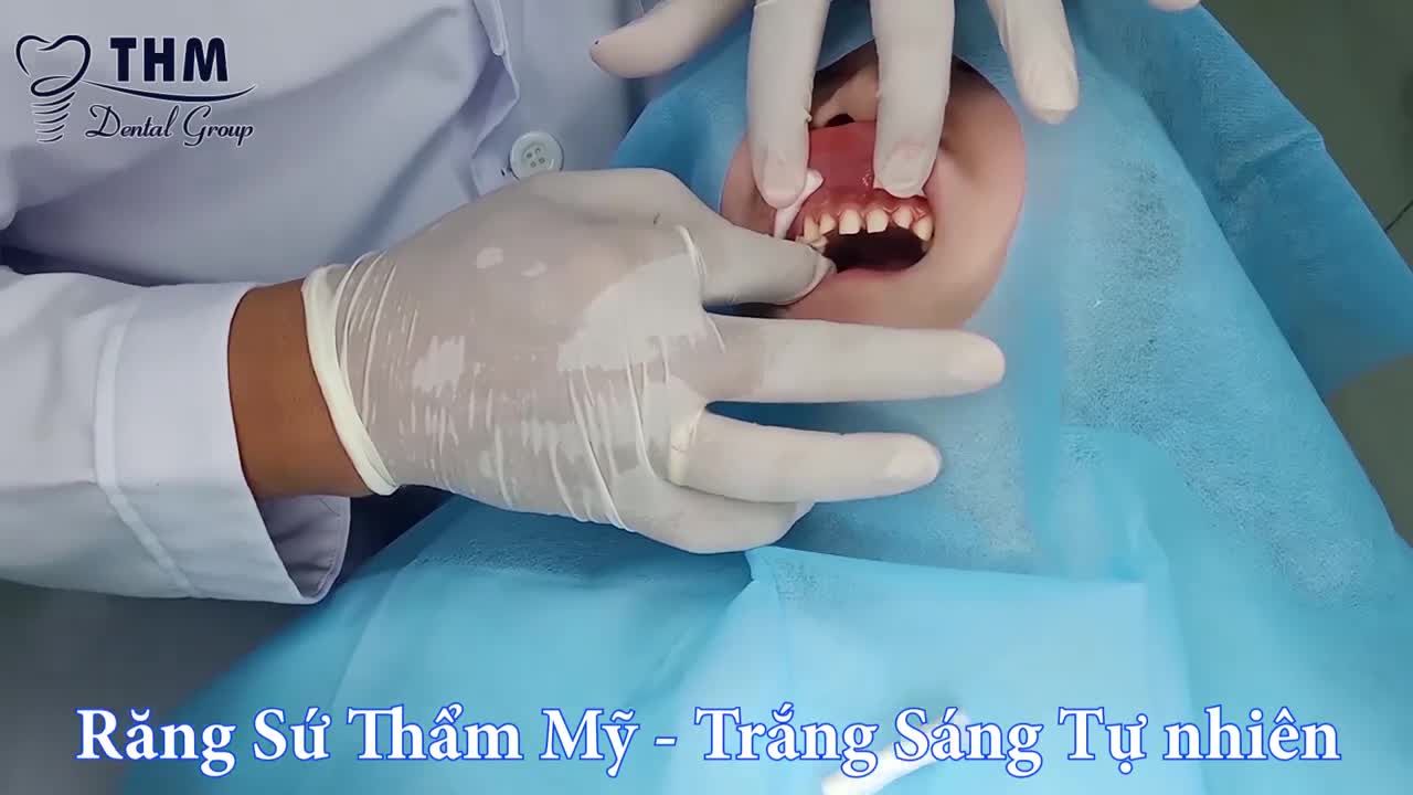 BẠN ĐANG TÌM KIẾM ĐỊA CHỈ THẨM MỸ RĂNG SỨ UY TÍN - CHUYÊN NGHIỆP TẠI TP.HCM