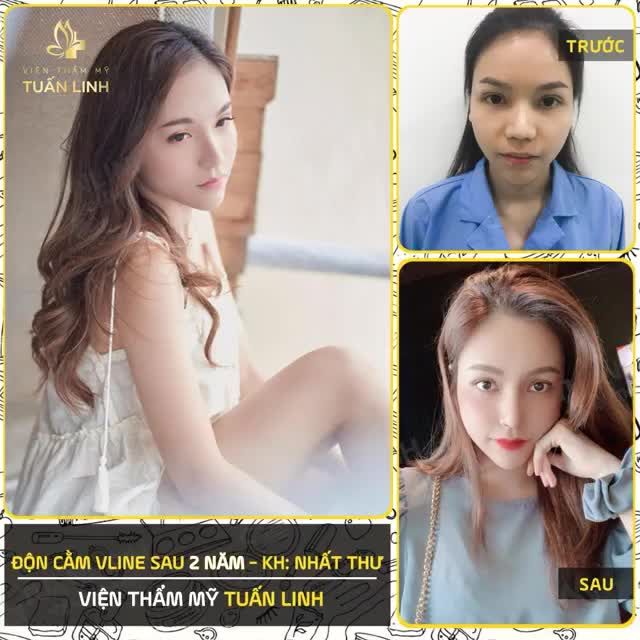 ĐỘN CẰM VLINE - BAI BAI GÓC CHẾT