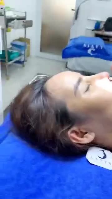 Khách khen không ngớt sau khi sửa lại mũi cấu trúc được 10 ngày