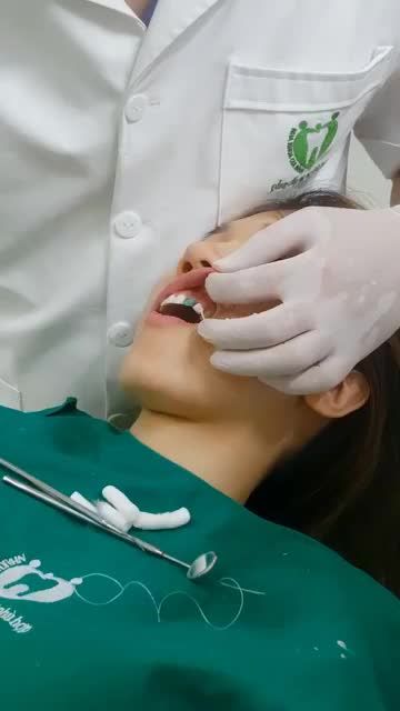 KHÔNG CÒN LO ÂU VÌ RĂNG XẤU – THAY ĐỔI NGAY SAU 24H