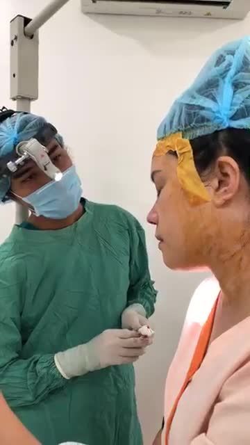 Lợi ích việc xem lại dáng mũi trước khi đóng vết khâu