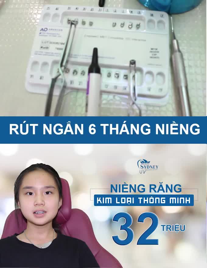 NIỀNG RĂNG CHO CON BỐ MẸ CẦN CHÚ Ý ĐIỀU GÌ