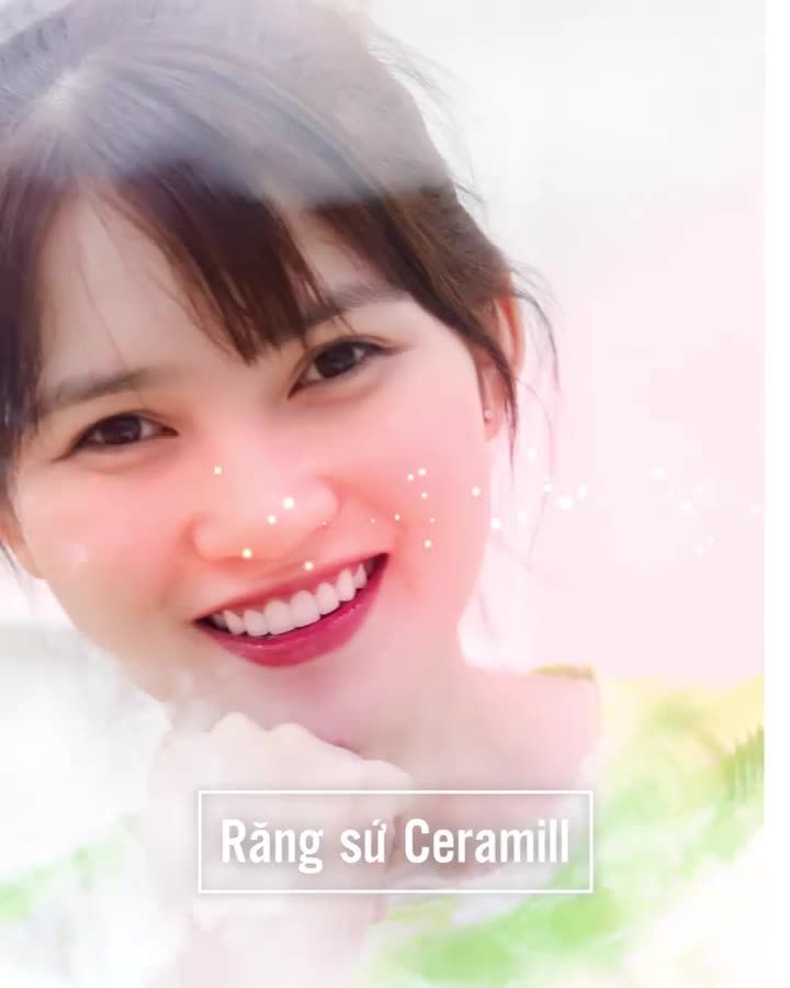 THÁNG CỦA NÀNG – ƯU ĐÃI LÊN ĐẾN 50% RĂNG THẨM MỸ