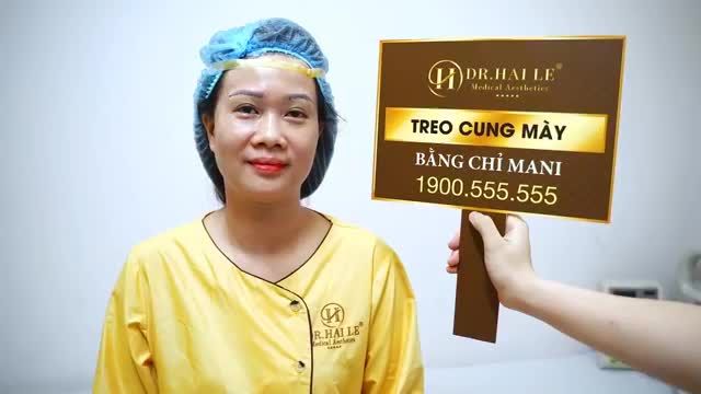 Nâng cung mày khẳng định sau phẫu thuật loại bỏ hoàn toàn tình trạng da sụp mí, già nua, u buồn trả lại từ 5-10 tuổi thanh xuân