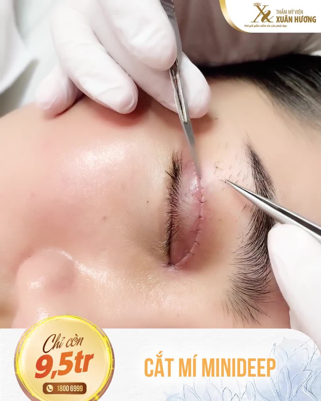 YÊU THƯƠNG BẢN THÂN - BẠN CHỌN CÁCH NÀO? CÔ GÁI NÀY CHỌN CÁCH TÂN TRANG NHAN SẮC VỚI CẮT MÍ MINIDEEP TẠI TMV XUÂN HƯƠNG