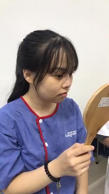 Kết quả ngay sau khi Nâng mũi cấu trúc 4D tại bệnh viện Thẩm mỹ Kangnm- thay đổi gương mặt, biến hoá hotgirl