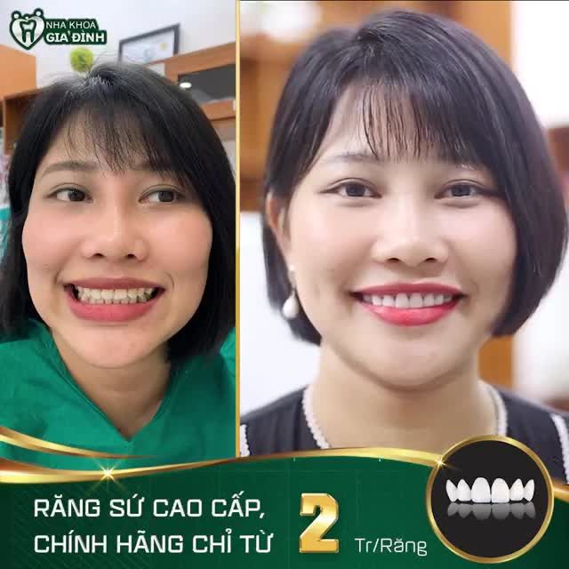TÂN TRANG NỤ CƯỜI – CHỊ EM TỰ TIN KHOE NHAN SẮC