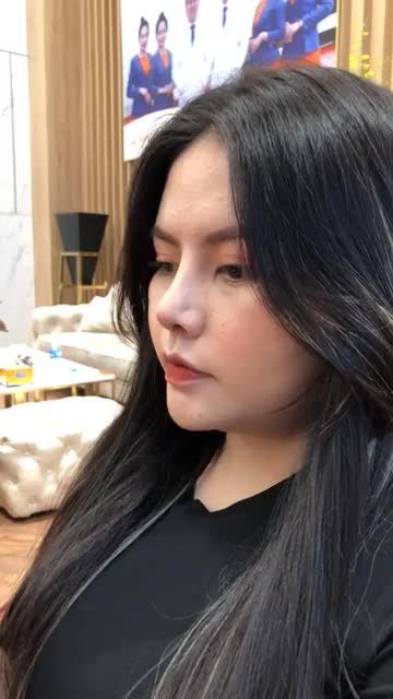 Mũi cấu trúc sau 10 ngày