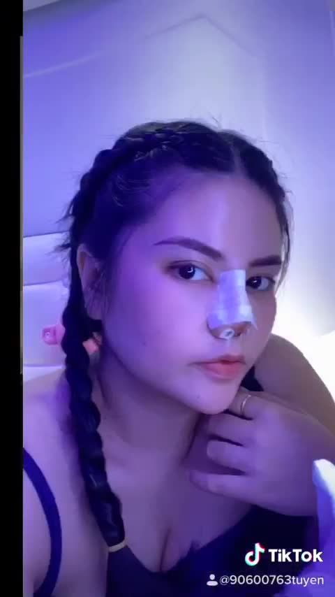 Một chiếc clip feedback khách hàng gửi cho AZ NOSE về hành trình biến đổi sau 10 ngày nâng mũi cấu trúc.