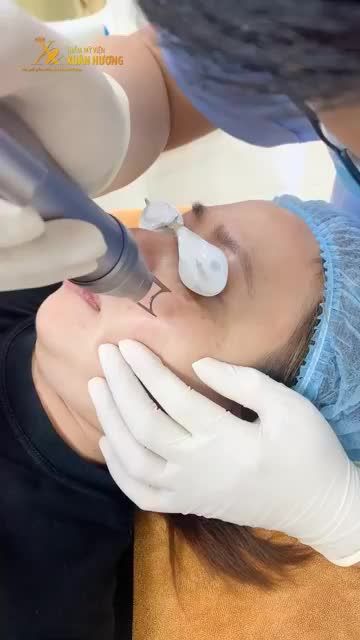 SAU KHI SINH CON, NÁM XUẤT HIỆN Ở TRÊN DA HÀNG CHỤC NĂM CHỮA MÃI KHÔNG KHỎI