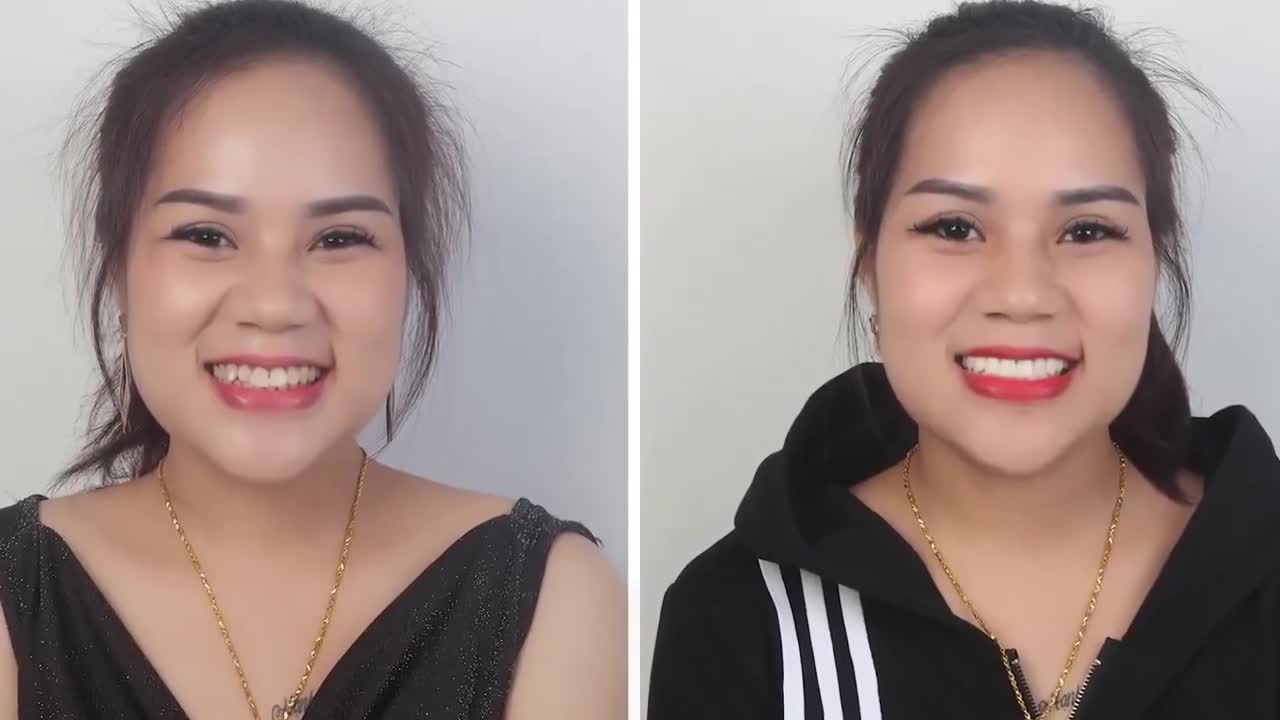 TỰ TIN VỚI HÀM RĂNG MỚI CÙNG NHA KHOA THÙY ANH.