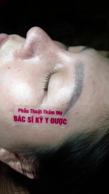 Mũi đẹp bung lụa sau 21 ngày tuổi nhe cả nhà