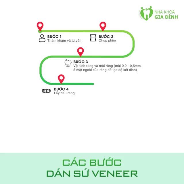 QUY TRÌNH DÁN SỨ VENEER NGHIÊM NGẶT TẠI NHA KHOA GIA ĐÌNH