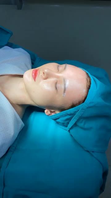 XEM NGAY KẾT QUẢ “CẤY MỠ TRÁN VÀ THÁI DƯƠNG” THAY ĐỔI GƯƠNG MẶT CHUẨN TỈ LỆ VÀNG