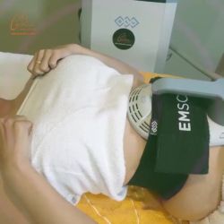 NÂNG CƠ EMSCULPT – CÔNG NGHỆ TẠO THÂN HÌNH SĂN CHẮC
