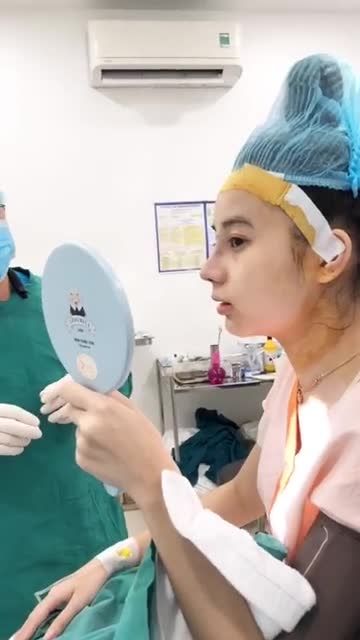 Sóng mũi ngắn - đầu mũi to cải thiện như thế nào sau nâng mũi?