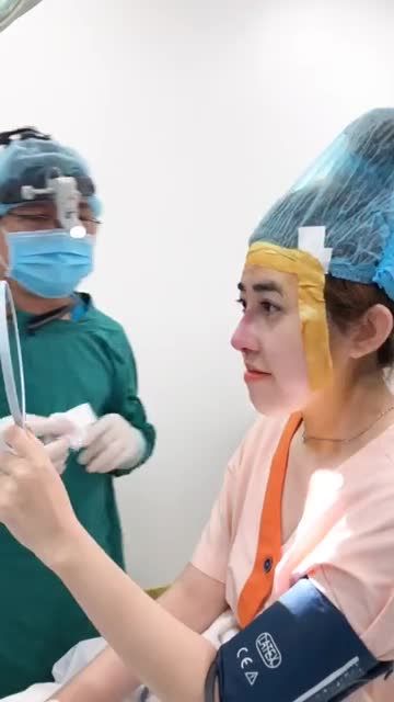 Ca mũi cấu trúc Sline cao cho khách hàng từng tiêm filler