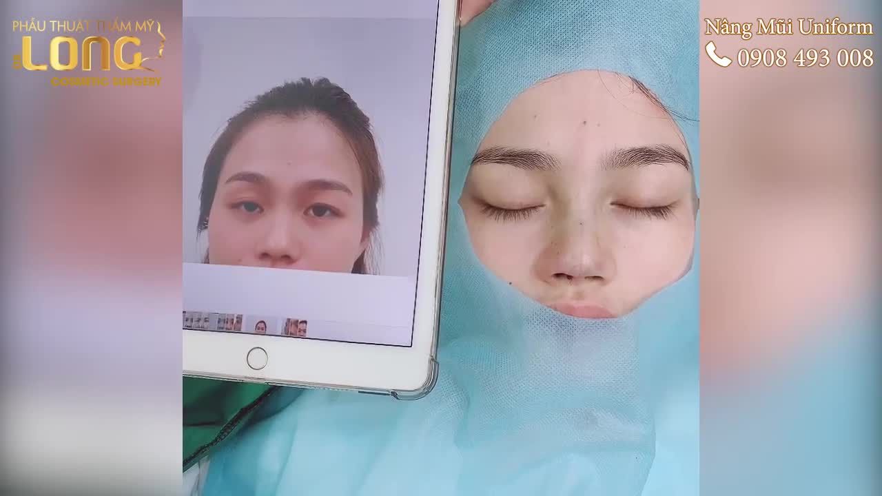 Muốn đẹp lên mà không ai biết mình thẩm mỹ ! Có Được Không ?