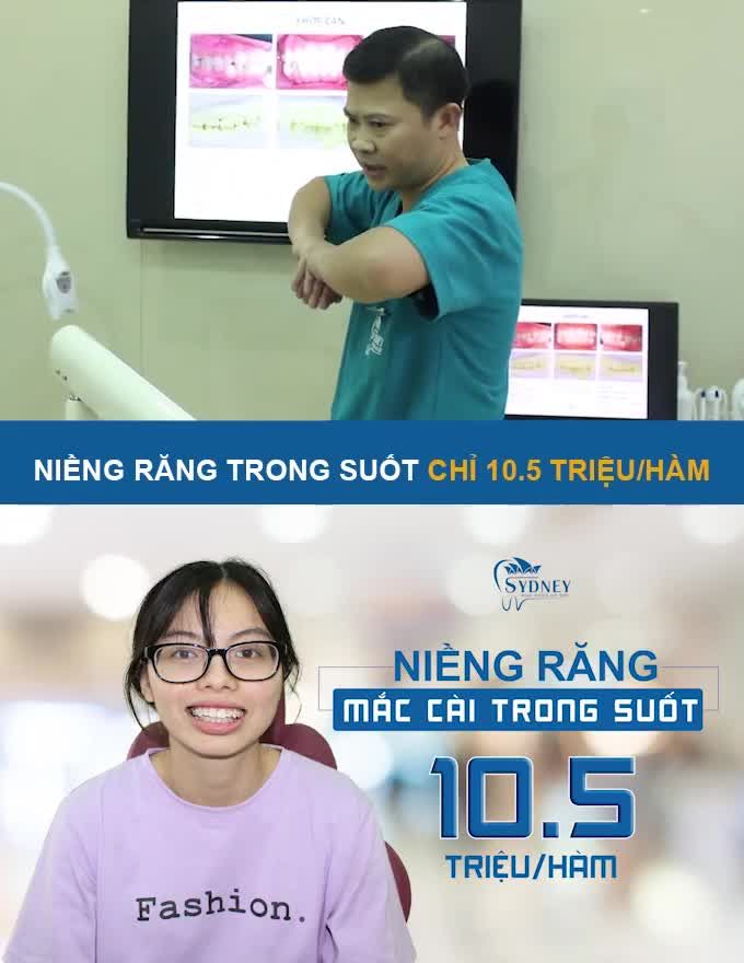 NIỀNG RĂNG MẮC CÀI PHA LÊ 10,5TR/HÀM CÓ XỨNG ĐÁNG