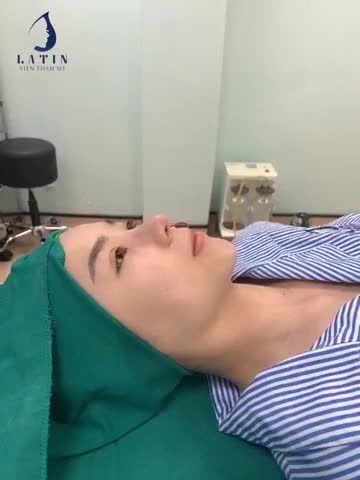 SỞ HỮU MŨI CAO, NGŨ QUAN TỎA SÁNG
