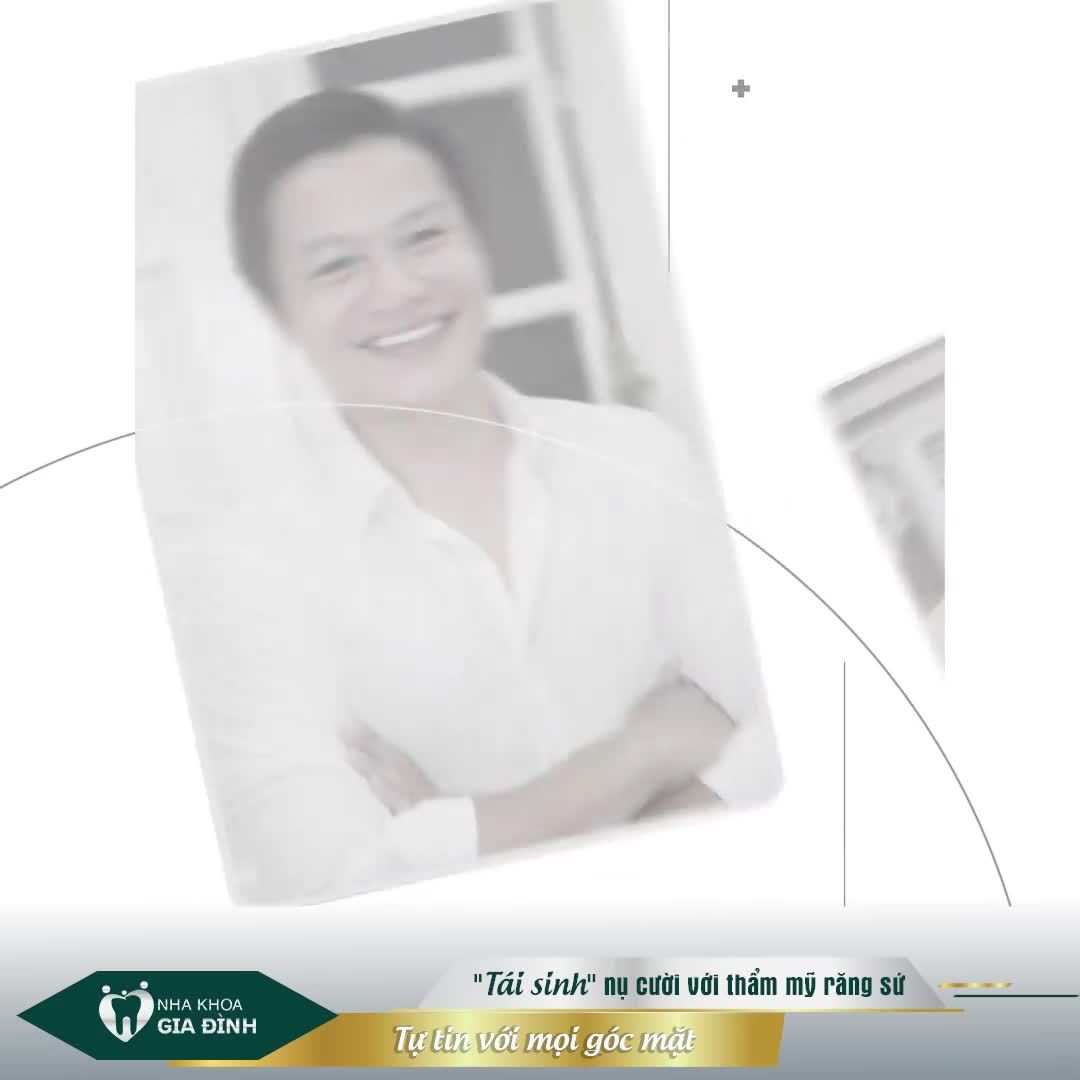 SỞ HỮU NỤ CƯỜI HOÀN HẢO VỚI THẨM MỸ RĂNG SỨ