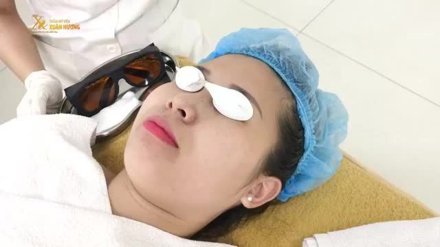 TÀN NHANG "CỨNG ĐẦU" ĐẾN ĐÂU CŨNG PHẢI "CHÀO THUA" SAU 1 BUỔI MELAS PICOSURE