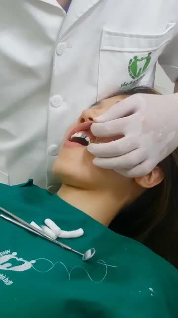 RĂNG XẤU CÀNG ĐỂ LÂU CÀNG NGHIÊM TRỌNG KHẮC PHỤC NGAY CHỈ SAU 2 LẦN HẸN CÙNG CHUYÊN GIA