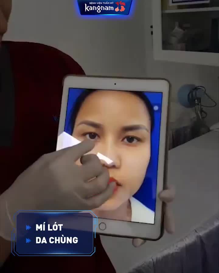 MÍ LÓT  Biến hình tức khắc sau BẤM MÍ MULTI-POINT