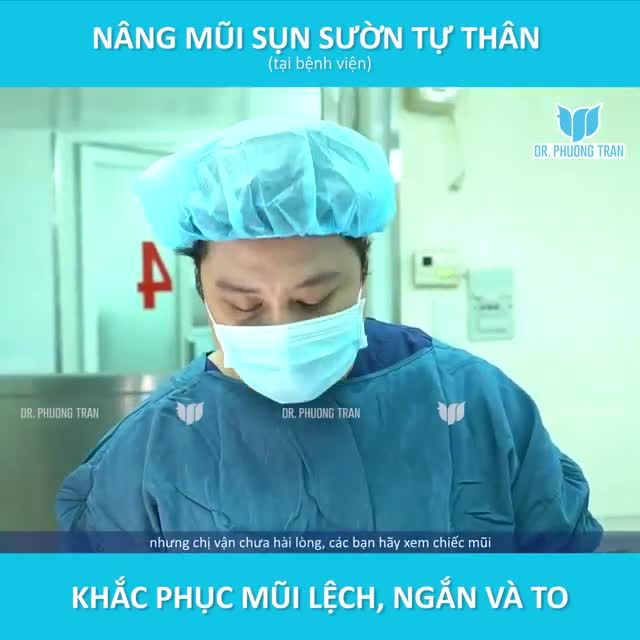 MŨI ĐÃ SỬA 2 LẦN, LỆCH, GÃY VÀ NGẮN SẼ THAY ĐỔI THẾ NÀO SAU NÂNG MŨI SỤN SƯỜN TỰ THÂN?