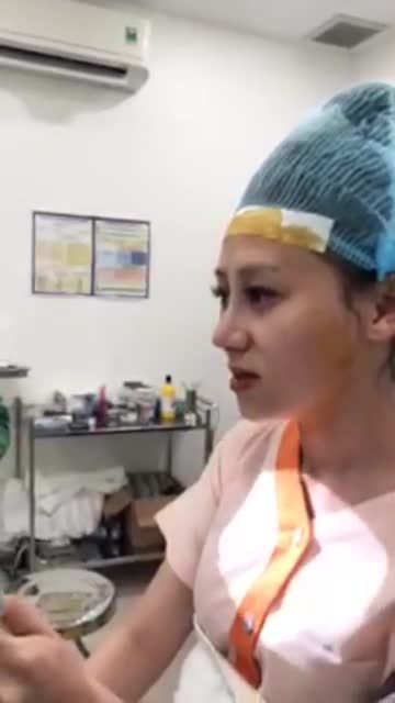 Sóng mũi thấp tẹt - đầu mũi to ngắn - trụ mũi tụt sâu