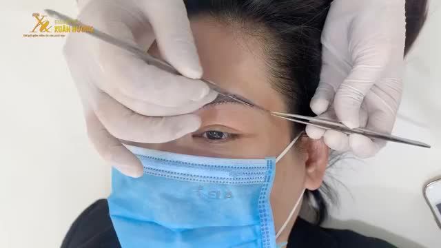 TRẺ RA TỚI 10 TUỔI SAU COMBO NÂNG CUNG MÀY + PHUN THÊU TẠI TMV XUÂN HƯƠNG