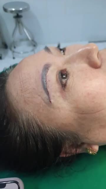 KHÁCH HÀNG BS KỲ Y DƯỢC TREO CUNG MÀY VỚI ĐƯỜNG KHÂU THẨM MỸ SIÊU MẢNH