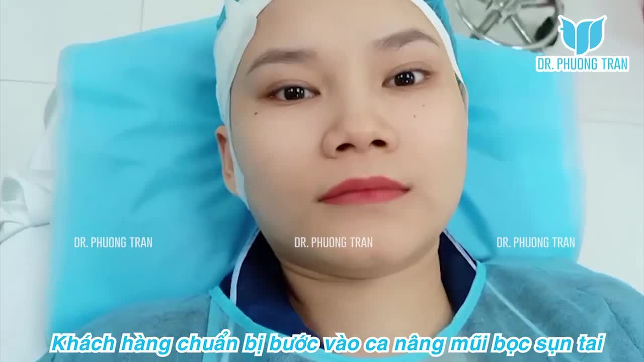 NÂNG MŨI ĐẶT SỐNG + BỌC SỤN TAI: GIẢI PHÁP TỐI ƯU CHO CHIẾC MŨI KHÔNG QUÁ NHIỀU KHUYẾT ĐIỂM