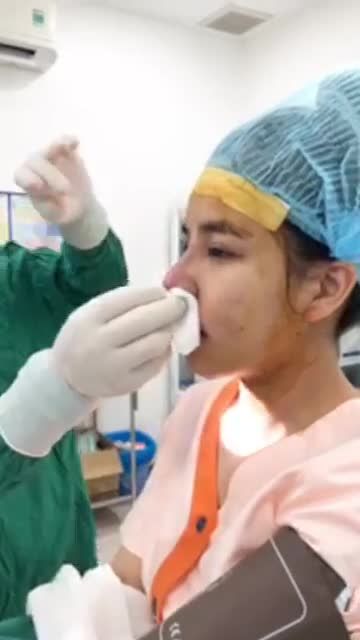Khắc phục óng mũi thấp - đầu mũi to bè