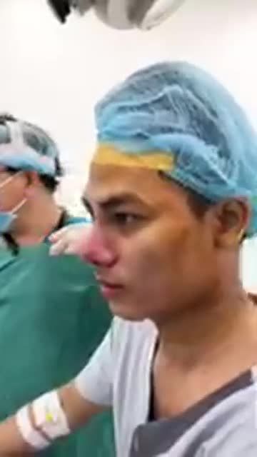 KHẮC PHỤC ĐẦU MŨI NGẮN VÀ SÓNG GÃY KHÚC