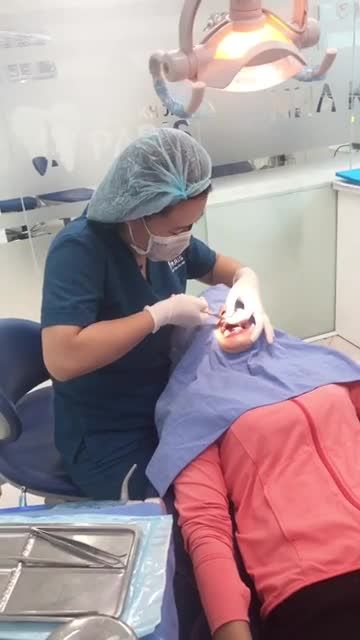 THÁO MẮC CÀI SAU 18 THÁNG CHỈNH NHA