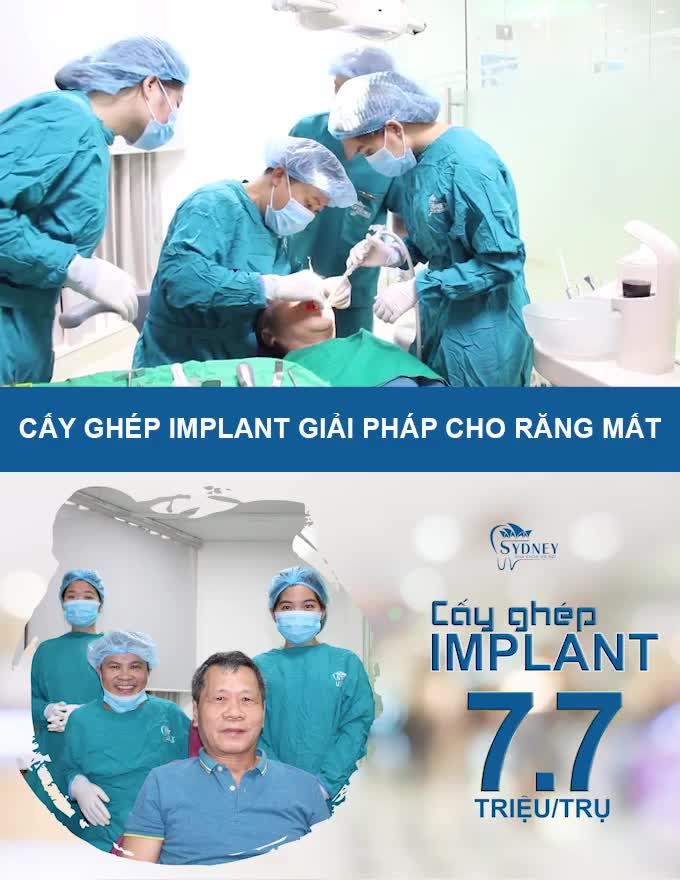 CẤY GHÉP RĂNG IMPLANT CÓ TỐT KHÔNG