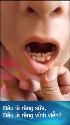 Chuyện chăm sóc răng miệng của trẻ đang bị cha mẹ xem nhẹ. Không ít bậc cha mẹ sẽ phủi tay, lắc đầu bởi suy nghĩ "đằng nào nó chả mọc răng khác".