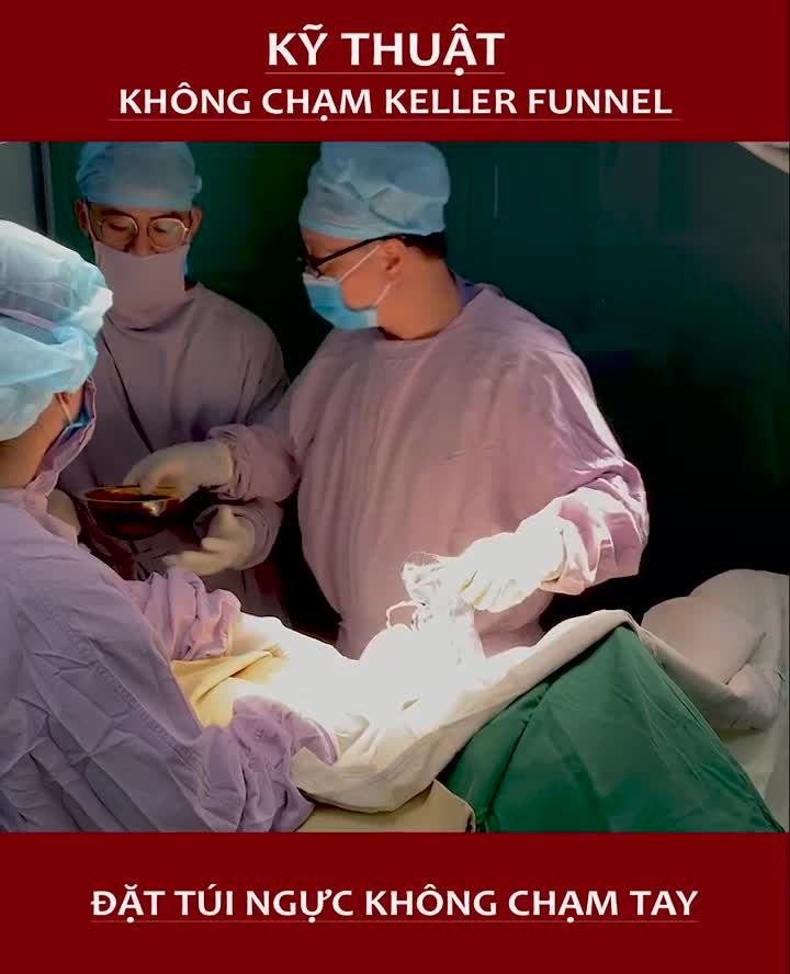 Nâng ngực không chạm - KELLER FUNNEL nói không với bao xơ