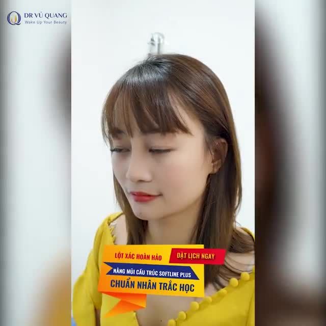 OFF 50% Nâng mũi cấu trúc Softline Plus