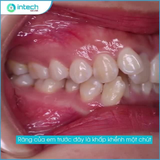 THAY ĐỔI NỤ CƯỜI, THAY ĐỔI BẢN THÂN