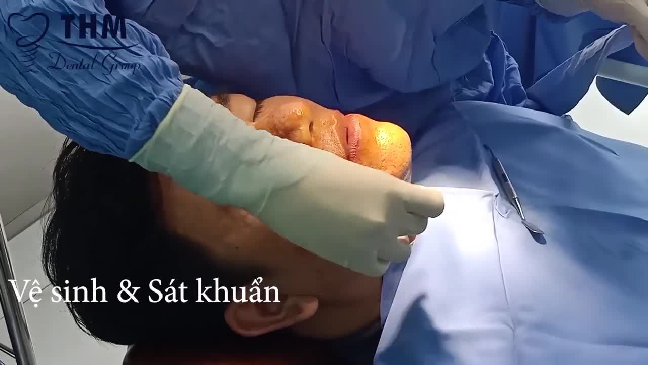TOÀN CẢNH CA TRỒNG RĂNG IMPLANT KHÔNG ĐAU TẠI NHA KHOA THẾ HỆ MỚI